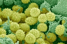 Grip Mikrobu Belirtileri ve Tedavisi