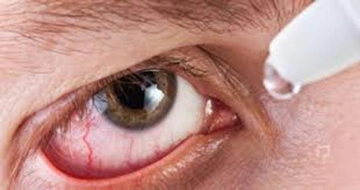 Gözün Mikrop Kapması Belirtileri ve Tedavisi