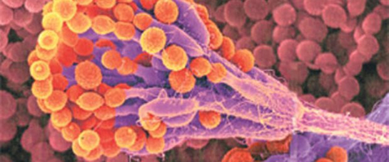 Hastane Mikrobu Belirtileri ve Tedavisi