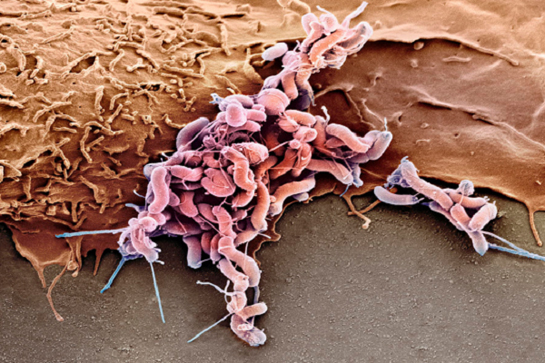 Mide Mikrobu Belirtileri ve Tedavisi